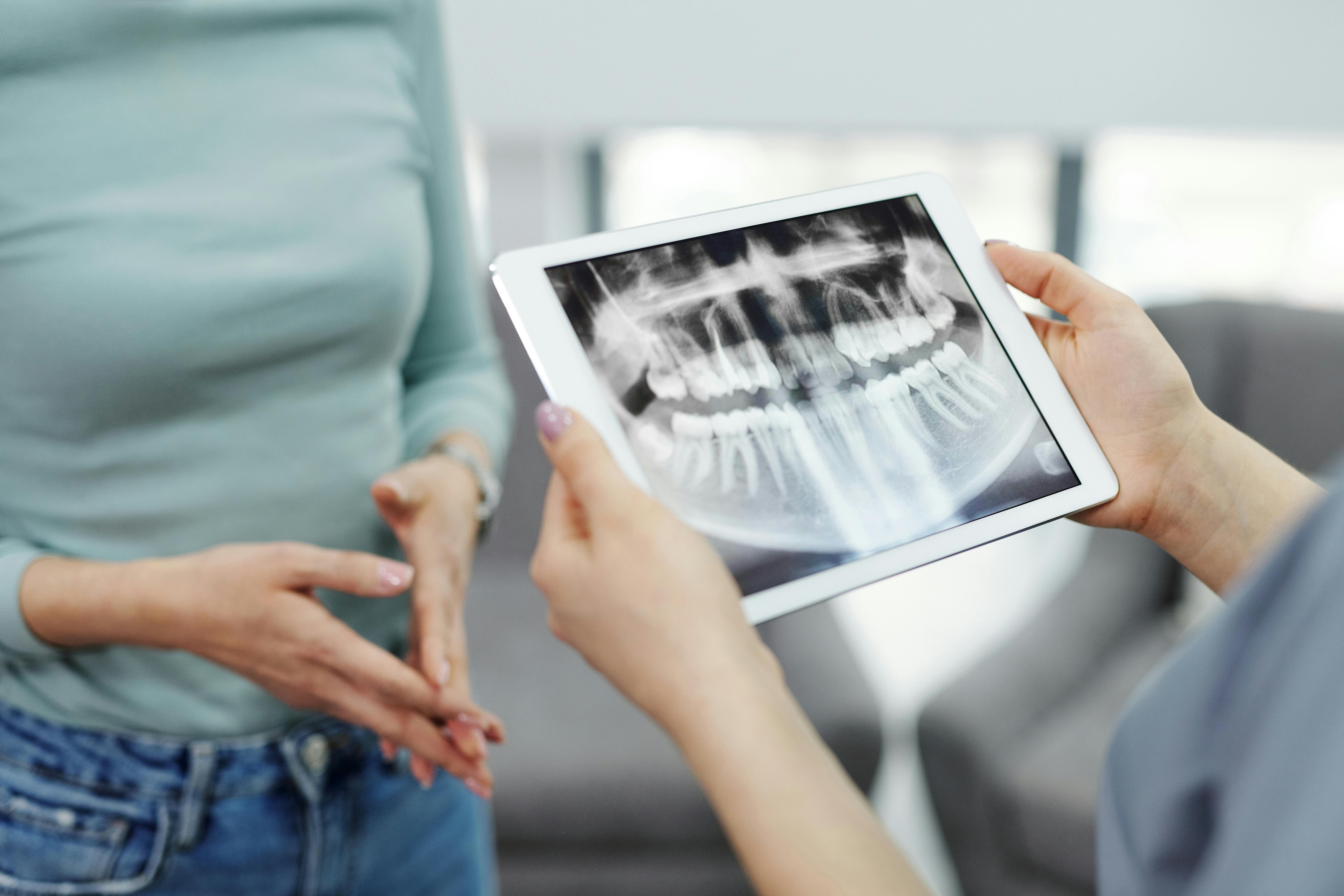 Survey: Most People Don’t Know Sleep Apnea Treatment Options