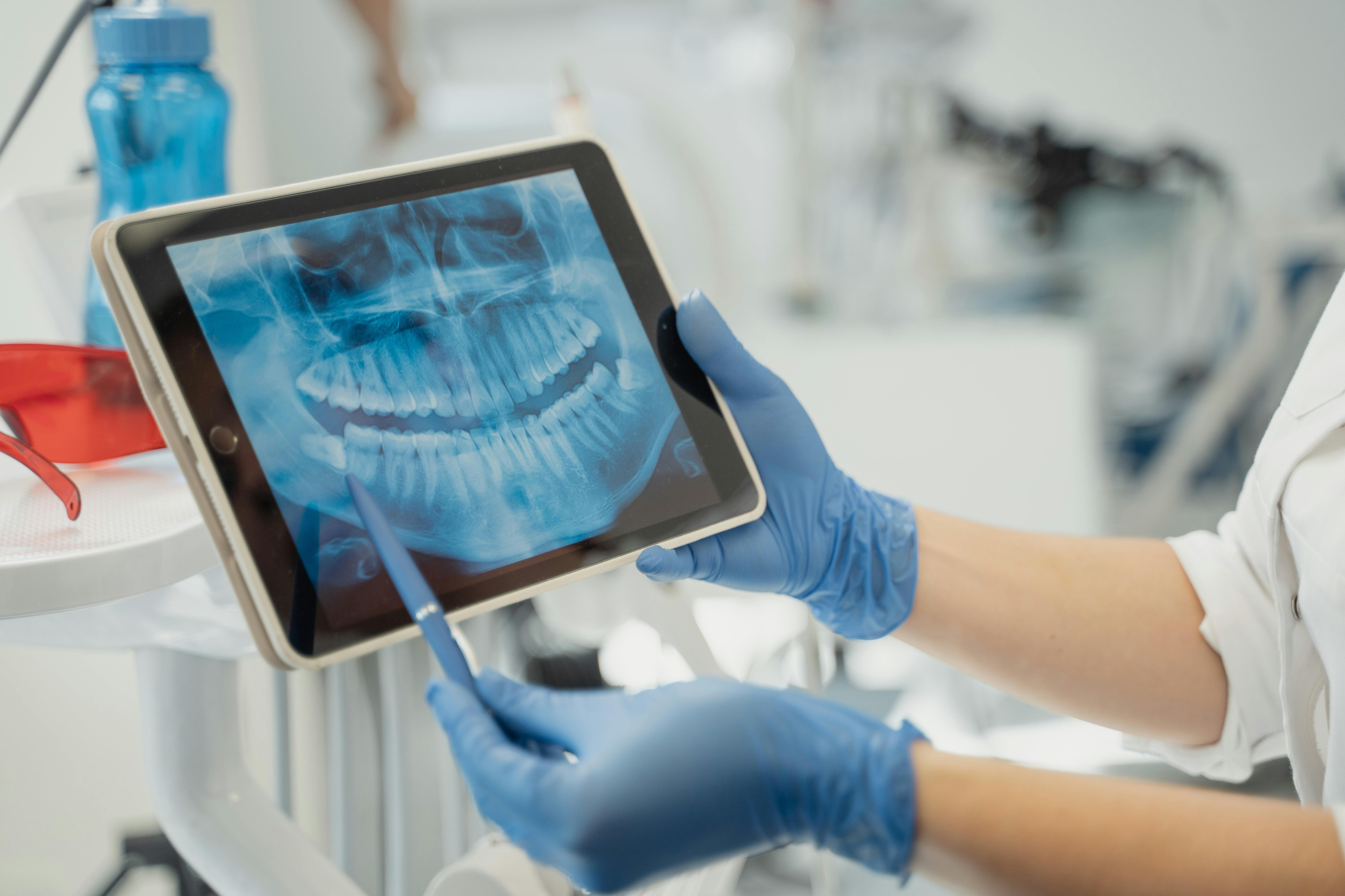 Wisdom Teeth Extractions 101